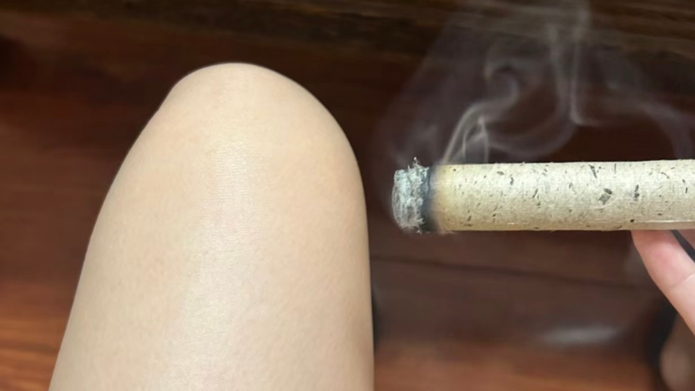 Moxibustion | 灸