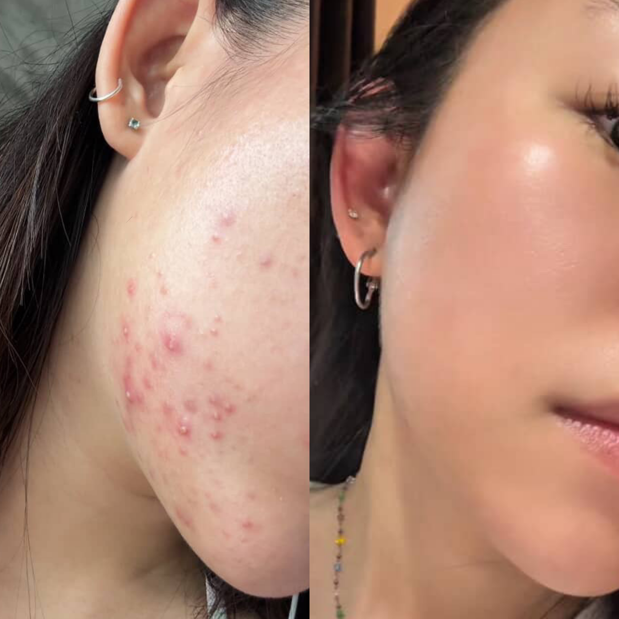 BEFORE_AFTER.png